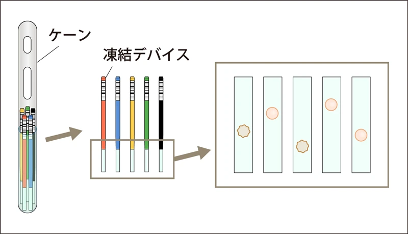 おち夢の卵子凍結【1個保存】